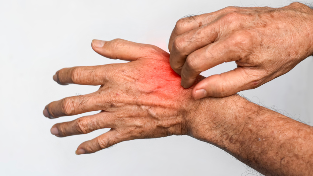 dampak kesehatan kekurangan air bersih