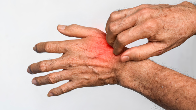 dampak kesehatan kekurangan air bersih